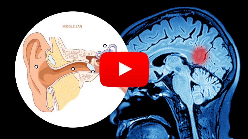 tinnitus discovery