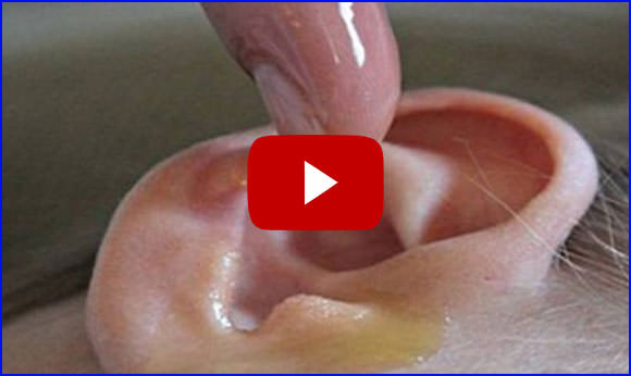 Ear Ringing Video